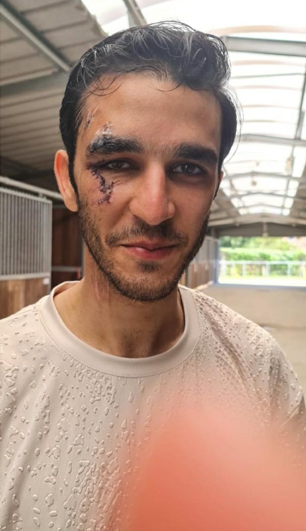 محمد طاهر يحصد المركز الخامس في بطولة فرنسا الدولية رغم إصابته